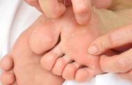 ۵ دلیل رایج پوسته پوسته‌شدن کف پا