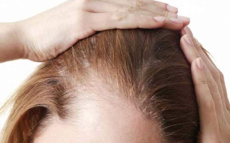 با ۸ درمان طبیعی برای مو‌های نازک آشنا شوید